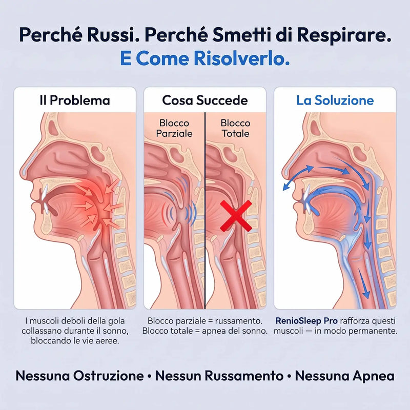 RenioSleep Pro — Elimina il Russamento e l'Apnea del Sonno
